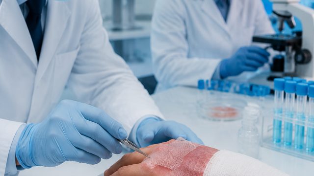 Revolutionary Advances in Skin Regeneration: The Future of Burn Healing